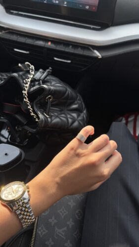 Coolest ring for pinky finger and toe photo review