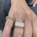 Zebra ring photo review